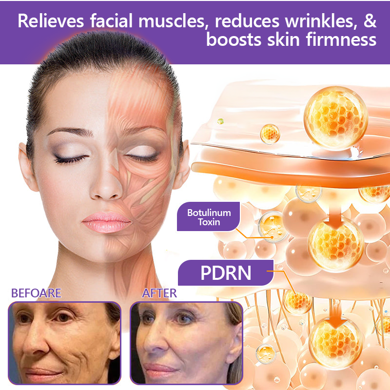 CE Certified: HISKIN® PDRN Multi-Peptide Massaging Body Roller Cream- Anti-aging, Hydrating, Skin Firming & Lifting, Skin Repair, Even Tone, Acne and Dark Spot Treatment, Wart and Mole Removal, and Psoriasis Relief.