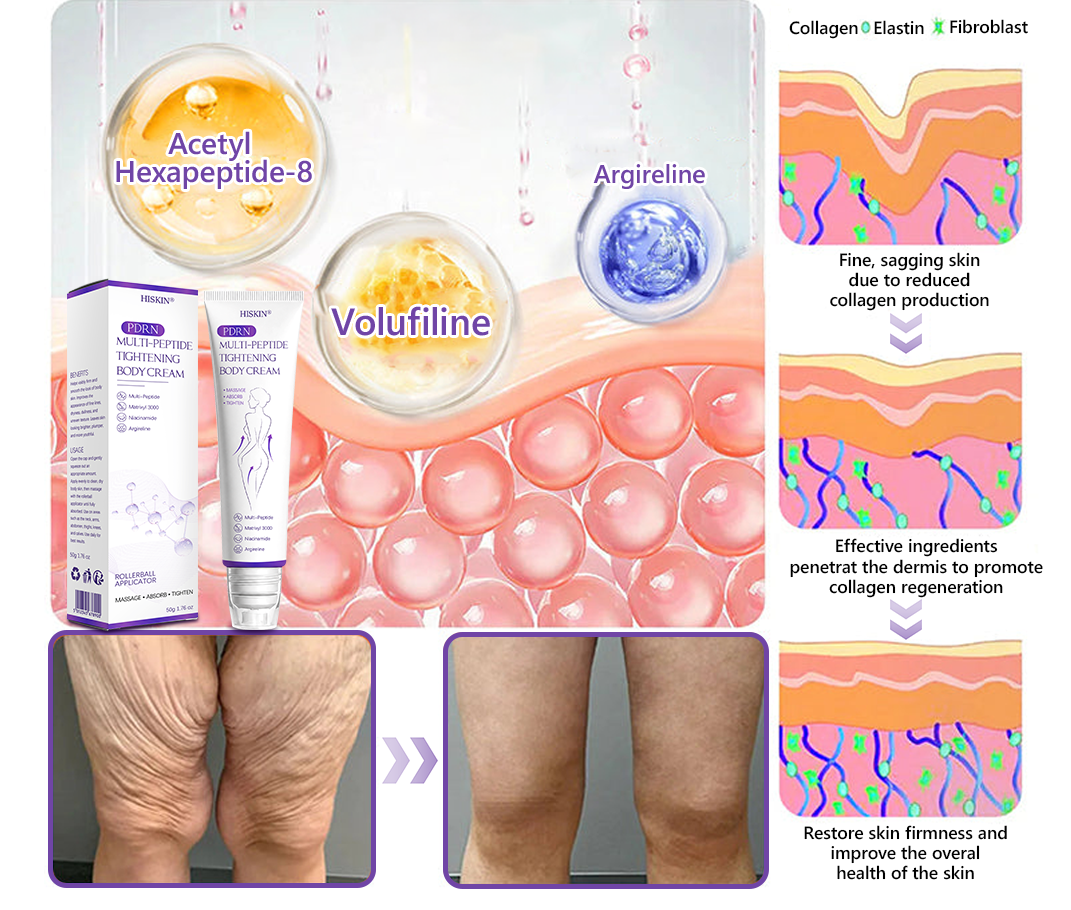 CE Certified: HISKIN® PDRN Multi-Peptide Massaging Body Roller Cream- Anti-aging, Hydrating, Skin Firming & Lifting, Skin Repair, Even Tone, Acne and Dark Spot Treatment, Wart and Mole Removal, and Psoriasis Relief.